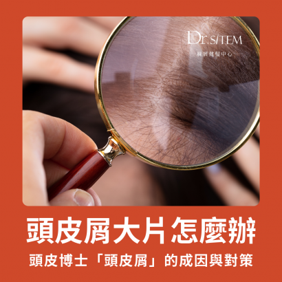 絲展健髮中心,頭皮保養,頭皮健康,頭皮屑大片頭皮博士,專業指南 絲展健髮中心,頭皮保養,頭皮健康,頭皮屑大片頭皮博士,專業指南