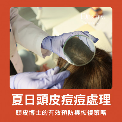 官網文章封夏日頭皮痘痘處理,絲展健髮中心面照to丁 _5_.png 官網文章封夏日頭皮痘痘處理,絲展健髮中心面照to丁 _5_.png