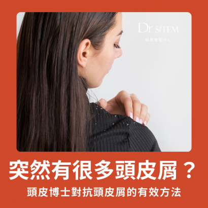 突然出現大量頭皮屑的 5 大原因 突然出現大量頭皮屑的 5 大原因