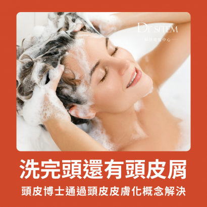夏日頭皮問題全解析:洗髮後仍有頭皮屑的原因與對策—Dr.Sitem絲展健髮中心 夏日頭皮問題全解析:洗髮後仍有頭皮屑的原因與對策—Dr.Sitem絲展健髮中心