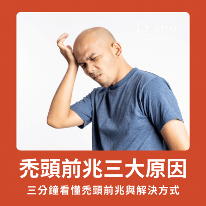 禿頭的前兆與三大原因解析 禿頭的前兆與三大原因解析